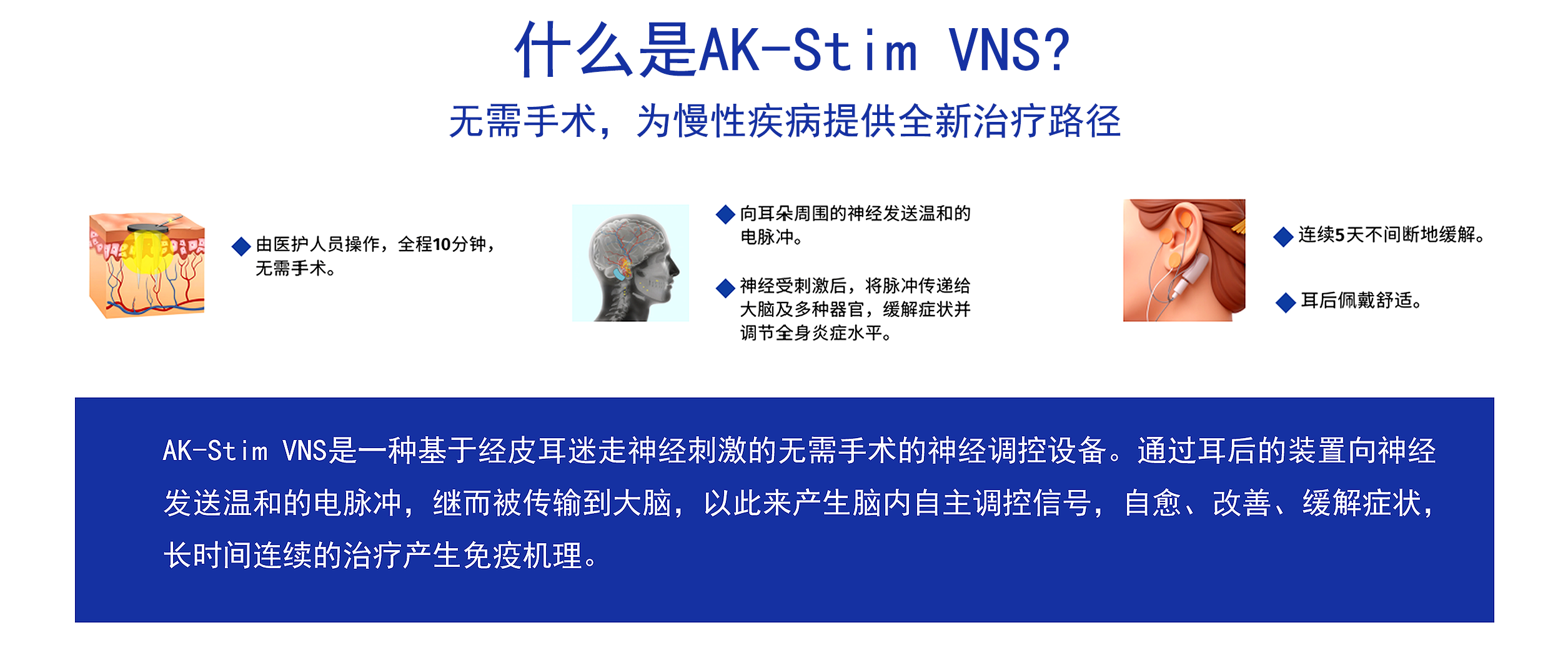 什么是AK-Stim VNS